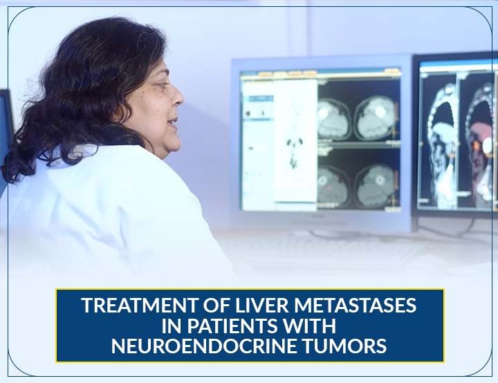 Treatment of Liver Metastases in patients with Neuroendocrine Tumors